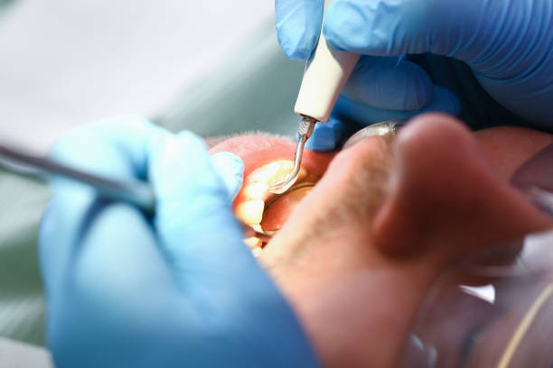 Best Emergency Root Canal Treatment in Hearne, TX