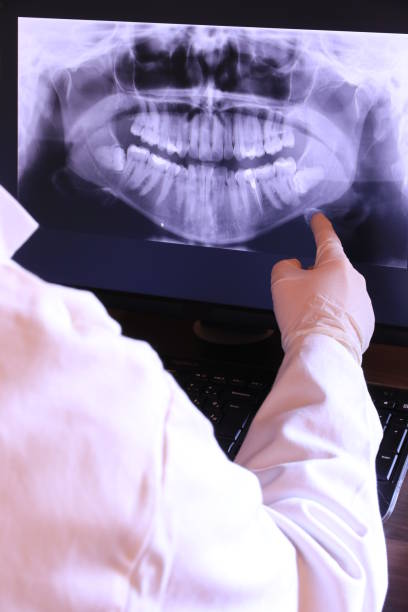 Best Emergency Treatment for Dental Infections or Abscesses in Hearne, TX