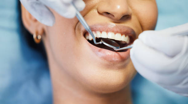 Best Emergency Gum Treatment in Hearne, TX