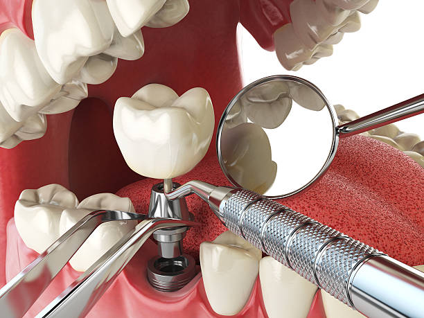 Best Emergency Treatment for Dental Infections or Abscesses in Hearne, TX